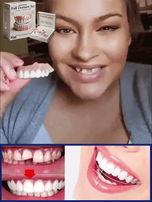 Flexible Denture Set for Upper and Lower Jaw – Reusable and Custom-Fit