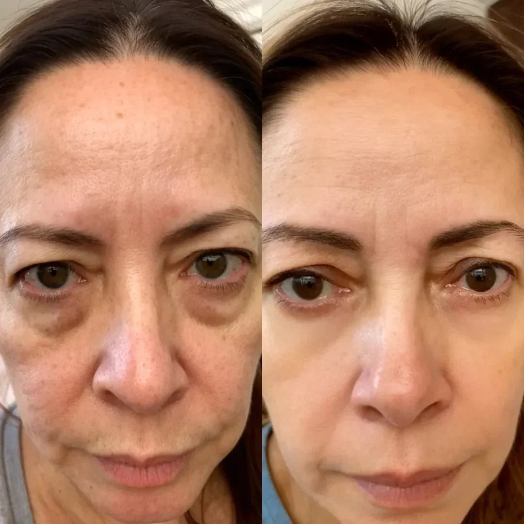 LumaNova Eye Rejuvenator for Red Light and Microcurrent Therapy