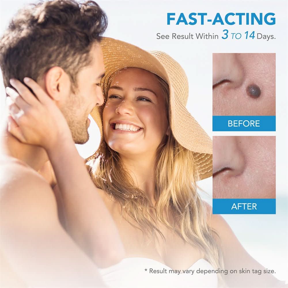 Dermaswift – Remove Skin Blemishes Against Warts and Skin Growths