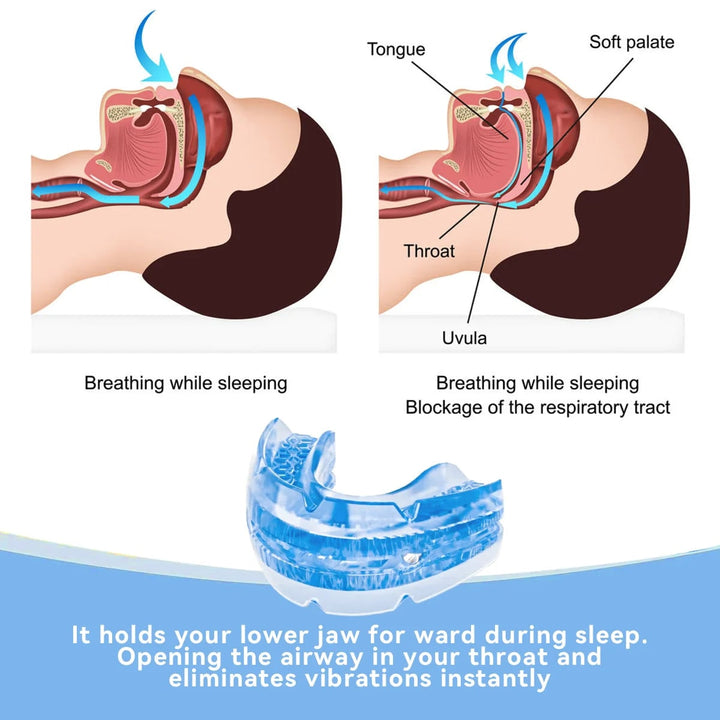 Adjustable Anti Snoring Mouthpiece Mouth Guard with Screwdriver and Storage Case Aid